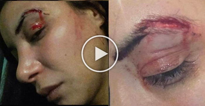 صورة بالفيديو.. الممثلة لبنى أبيضار تتعرض لاعتداء خطير وتتهم الأمن والمصحات بعدم استقبالها